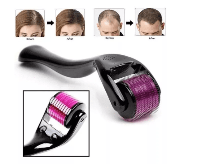 Dermaroller Facial con Microagujas | Masajeador para Rostro y Cuerpo, Regeneración y Rejuvenecimiento - Image 4